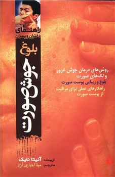 راهنمای دختران و پسران_جوش صورت/پیدایش
